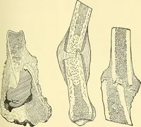 Picture 50 of 481 from Modern surgery, general and operative / by John Chalmers Da Costa. (1907), leaf 127