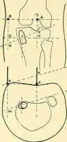 Picture 481 of 481 from Modern surgery, general and operative / by John Chalmers Da Costa. (1907), leaf 1277