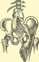 Picture 56 of 481 from Modern surgery, general and operative / by John Chalmers Da Costa. (1907), leaf 158