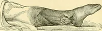 An illustration from Modern surgery, general and operative / by John Chalmers Da Costa. (1907)