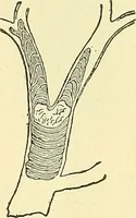 Picture 62 of 481 from Modern surgery, general and operative / by John Chalmers Da Costa. (1907), leaf 195