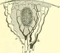 Picture 63 of 481 from Modern surgery, general and operative / by John Chalmers Da Costa. (1907), leaf 196