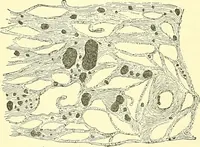 Picture 64 of 481 from Modern surgery, general and operative / by John Chalmers Da Costa. (1907), leaf 198