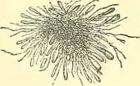 Picture 2 of 481 from Modern surgery, general and operative / by John Chalmers Da Costa. (1907), leaf 22