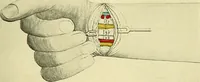 Picture 67 of 481 from Modern surgery, general and operative / by John Chalmers Da Costa. (1907), leaf 253