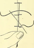 Picture 70 of 481 from Modern surgery, general and operative / by John Chalmers Da Costa. (1907), leaf 254