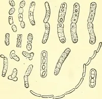 Picture 6 of 481 from Modern surgery, general and operative / by John Chalmers Da Costa. (1907), leaf 26