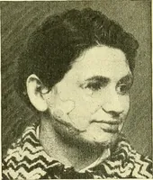 An illustration from Modern surgery, general and operative / by John Chalmers Da Costa. (1907)