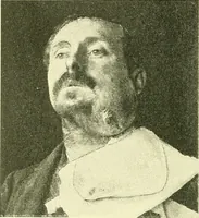 Picture 79 of 481 from Modern surgery, general and operative / by John Chalmers Da Costa. (1907), leaf 324