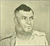 Picture 80 of 481 from Modern surgery, general and operative / by John Chalmers Da Costa. (1907), leaf 326