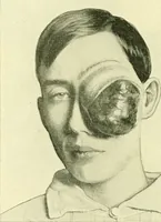 Picture 81 of 481 from Modern surgery, general and operative / by John Chalmers Da Costa. (1907), leaf 328