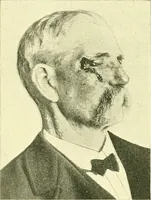 Picture 83 of 481 from Modern surgery, general and operative / by John Chalmers Da Costa. (1907), leaf 340