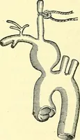 Picture 88 of 481 from Modern surgery, general and operative / by John Chalmers Da Costa. (1907), leaf 372