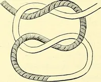 Picture 96 of 481 from Modern surgery, general and operative / by John Chalmers Da Costa. (1907), leaf 384