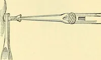 An illustration from Modern surgery, general and operative / by John Chalmers Da Costa. (1907)