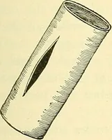 Picture 106 of 481 from Modern surgery, general and operative / by John Chalmers Da Costa. (1907), leaf 393