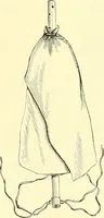 Picture 108 of 481 from Modern surgery, general and operative / by John Chalmers Da Costa. (1907), leaf 398