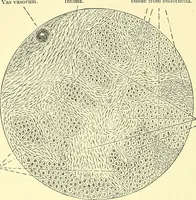 Picture 111 of 481 from Modern surgery, general and operative / by John Chalmers Da Costa. (1907), leaf 410