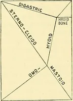 Picture 114 of 481 from Modern surgery, general and operative / by John Chalmers Da Costa. (1907), leaf 425