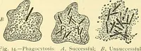 Picture 8 of 481 from Modern surgery, general and operative / by John Chalmers Da Costa. (1907), leaf 43