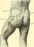 An illustration from Modern surgery, general and operative / by John Chalmers Da Costa. (1907)