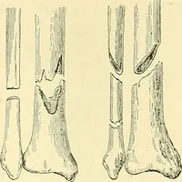 Picture 120 of 481 from Modern surgery, general and operative / by John Chalmers Da Costa. (1907), leaf 461
