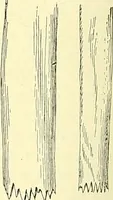 Picture 123 of 481 from Modern surgery, general and operative / by John Chalmers Da Costa. (1907), leaf 462