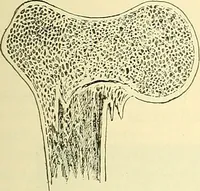 Picture 124 of 481 from Modern surgery, general and operative / by John Chalmers Da Costa. (1907), leaf 463