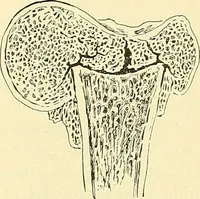 Picture 127 of 481 from Modern surgery, general and operative / by John Chalmers Da Costa. (1907), leaf 463