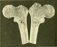 Picture 128 of 481 from Modern surgery, general and operative / by John Chalmers Da Costa. (1907), leaf 464