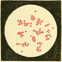 Picture 9 of 481 from Modern surgery, general and operative / by John Chalmers Da Costa. (1907), leaf 47