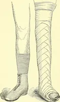 Picture 129 of 481 from Modern surgery, general and operative / by John Chalmers Da Costa. (1907), leaf 476