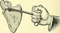 Picture 130 of 481 from Modern surgery, general and operative / by John Chalmers Da Costa. (1907), leaf 478