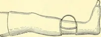 Picture 133 of 481 from Modern surgery, general and operative / by John Chalmers Da Costa. (1907), leaf 480
