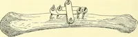 Picture 134 of 481 from Modern surgery, general and operative / by John Chalmers Da Costa. (1907), leaf 480