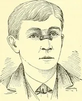 An illustration from Modern surgery, general and operative / by John Chalmers Da Costa. (1907)