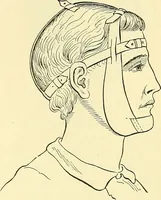 An illustration from Modern surgery, general and operative / by John Chalmers Da Costa. (1907)