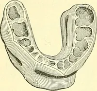 Picture 140 of 481 from Modern surgery, general and operative / by John Chalmers Da Costa. (1907), leaf 488