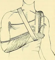 Picture 141 of 481 from Modern surgery, general and operative / by John Chalmers Da Costa. (1907), leaf 497