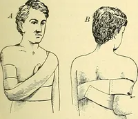 An illustration from Modern surgery, general and operative / by John Chalmers Da Costa. (1907)