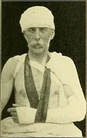 Picture 144 of 481 from Modern surgery, general and operative / by John Chalmers Da Costa. (1907), leaf 503