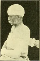 Picture 145 of 481 from Modern surgery, general and operative / by John Chalmers Da Costa. (1907), leaf 503