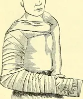 Picture 146 of 481 from Modern surgery, general and operative / by John Chalmers Da Costa. (1907), leaf 504
