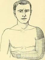 An illustration from Modern surgery, general and operative / by John Chalmers Da Costa. (1907)