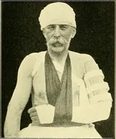 Picture 148 of 481 from Modern surgery, general and operative / by John Chalmers Da Costa. (1907), leaf 507
