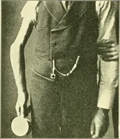 Picture 151 of 481 from Modern surgery, general and operative / by John Chalmers Da Costa. (1907), leaf 510