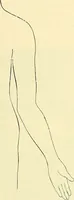 An illustration from Modern surgery, general and operative / by John Chalmers Da Costa. (1907)