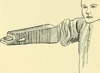 Picture 156 of 481 from Modern surgery, general and operative / by John Chalmers Da Costa. (1907), leaf 519