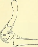 An illustration from Modern surgery, general and operative / by John Chalmers Da Costa. (1907)