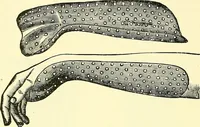 Picture 159 of 481 from Modern surgery, general and operative / by John Chalmers Da Costa. (1907), leaf 524